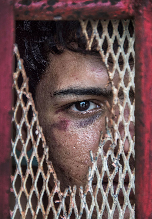 Nikon Walkley Portrait Prize 2016 - "Beaten Refugee" - by Brian Cassey