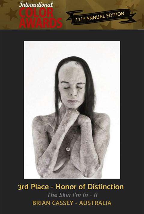 International Color Awards - Honor of Distinction - Portraits - "The Skin I'm In - II" by Brian Cassey