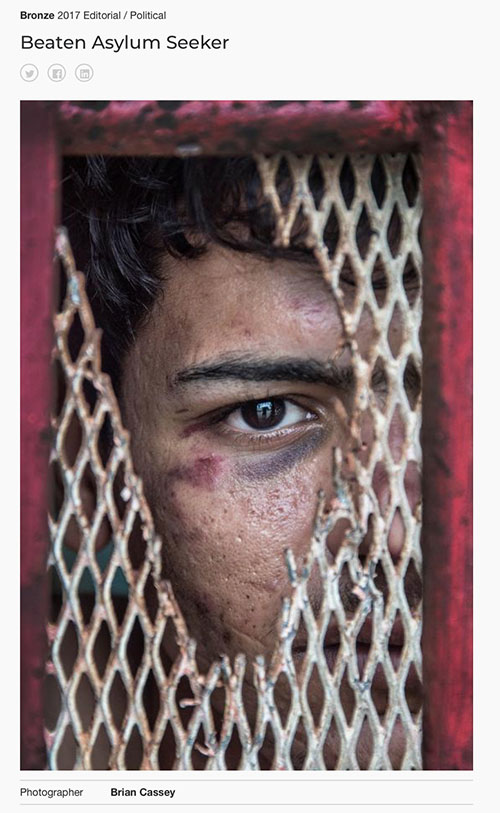 Tokyo International Foto Awards (TIFA) - Bronze Prize (Third) - Editorial Political - "Beaten Asylum Seeker" by Brian Cassey
