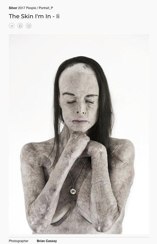 Tokyo International Foto Awards (TIFA) - Silver Prize (Second) - Portrait - "The Skin I'm In - II" by Brian Cassey