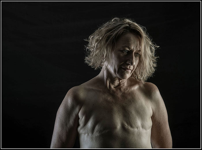 'Kate - Waiting For Her New Breasts' - Finalist - Percival Photographic Portrait Prize 2020 - image by Brian Cassey