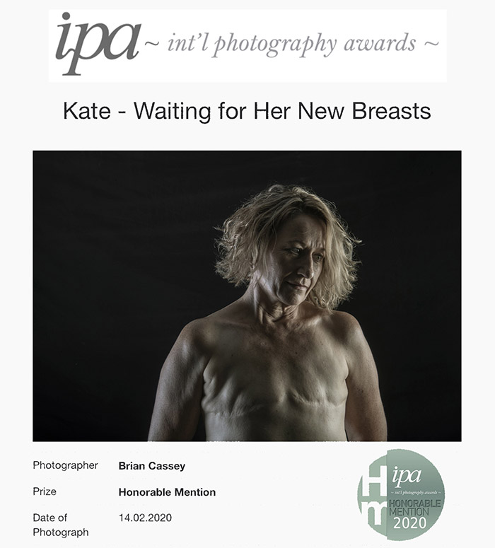 International Photography Awards (IPA) - Honorable Mention - Editorial Contemporary Issues - 'Kate - Waiting For Her New Breasts' - image by Brian Cassey