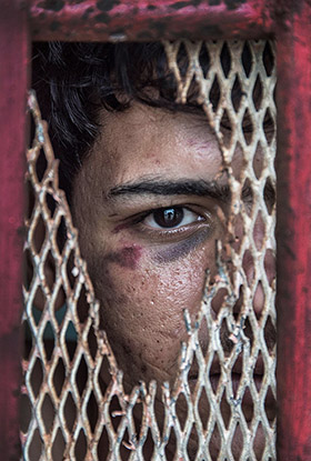'Abdullatif - Beaten Asylum Seeker' - Winner 2016 Nikon Walkley Portrait Prize - image by Brian Cassey